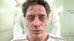 Robert Downey Jr. in The Singing Detective. Robert Downey Jr. in The Singing Detective.